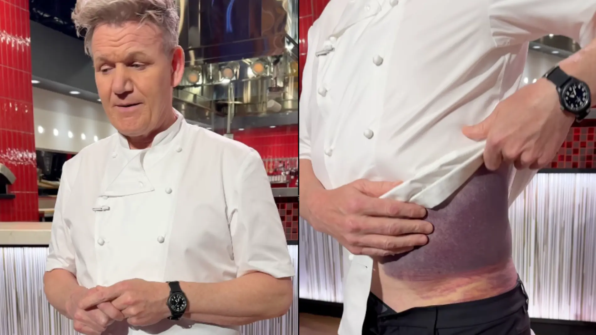 Gordon Ramsey sufre accidente en bicicleta (1)